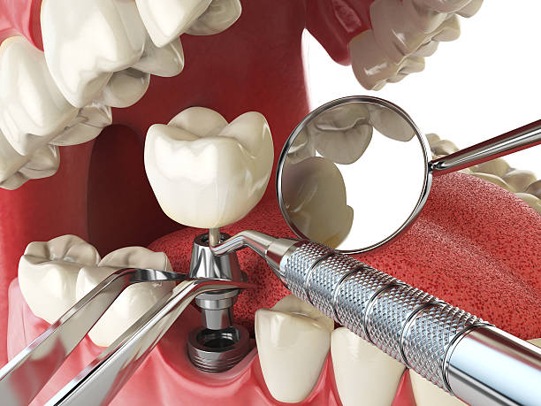 Best Pediatric Emergency Dentist in Moyie Springs, ID